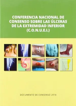 CONFERENCIA NACIONAL DE CONSENSO SOBRE LAS ULCERAS DE LA EXTREMIDAD Última Oportunidad